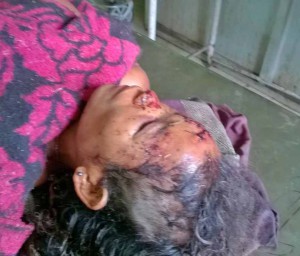 Nimai-Rabha-beaten-in-attack-in-Assam-state-India.-Morning-Star-News